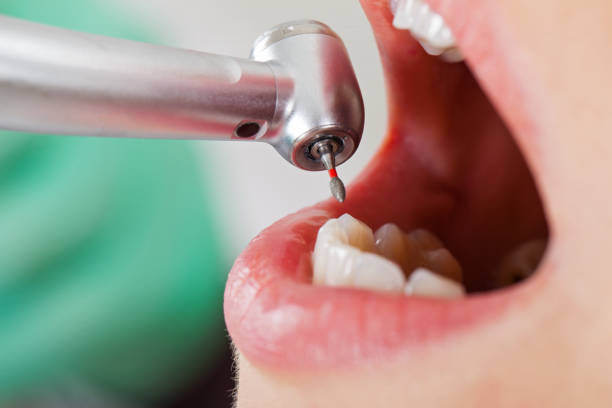 Best Emergency Denture Repair in Sarand, AL